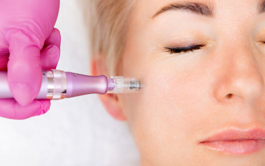 Microneedling: welche Vorteile bietet dieser Trend?